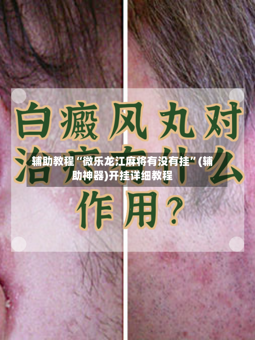 辅助教程“微乐龙江麻将有没有挂”(辅助神器)开挂详细教程